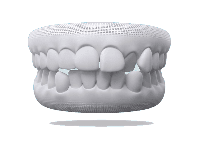 General Alignment smile example