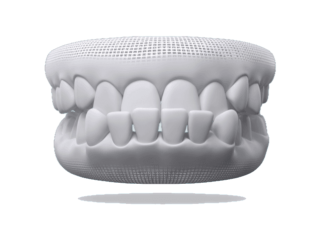 Underbite smile example