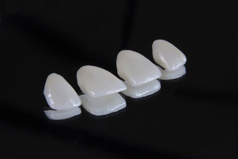 Cover Image for Dental Veneers